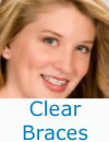 Clear Braces Logo 100