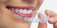 Invisalign Aligner 200